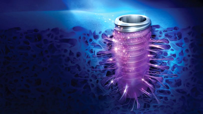 TS SOI de Osstem Implant alcanza un crecimiento anual del 46% en ventas en Europa